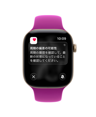 ライトゴールドアルミニウムケースのApple Watch Series 12。周期の偏差の可能性を示す通知が表示され、マゼンタのスポーツバンドが取りつけられている